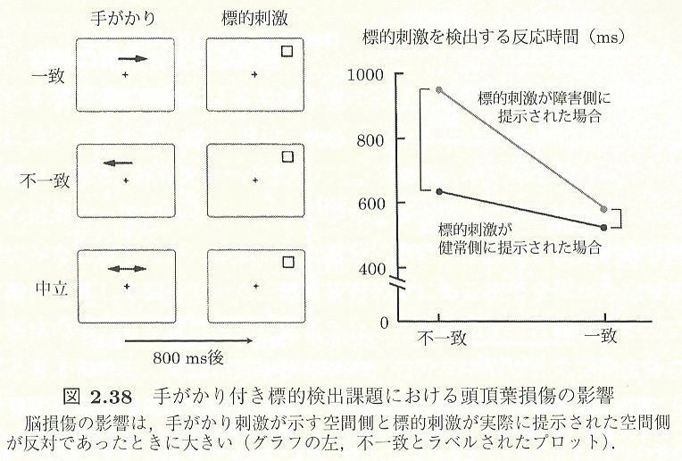 半側空間無視の病態神経学 前頭 頭頂葉ネットワークの機能結合の破綻 Keep On Thinking