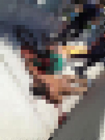 グロ注意 生きたまま顔面を食われた被害者の画像が流出 ひたすら映画を観まくる日記アルティメット エディション