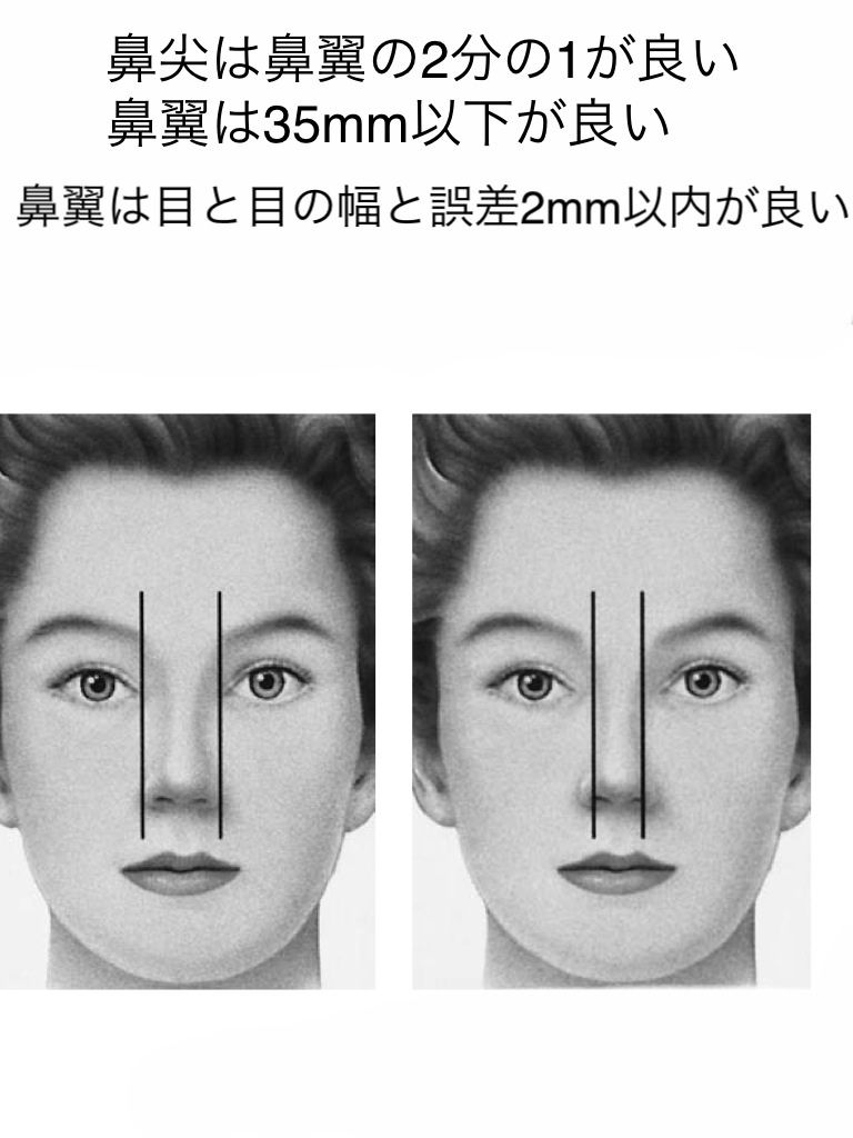 鼻のバランス 現代美容整形理論