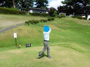 Aさん