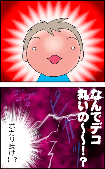 ちくわの穴から星☆を見た *4コマ-日焼け2
