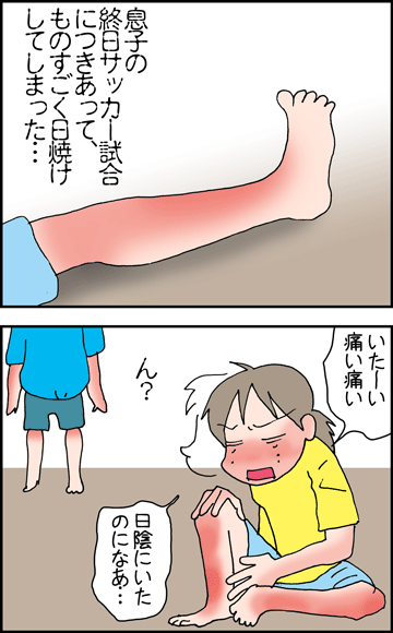 ちくわの穴から星☆を見た *4コマ-日焼け1