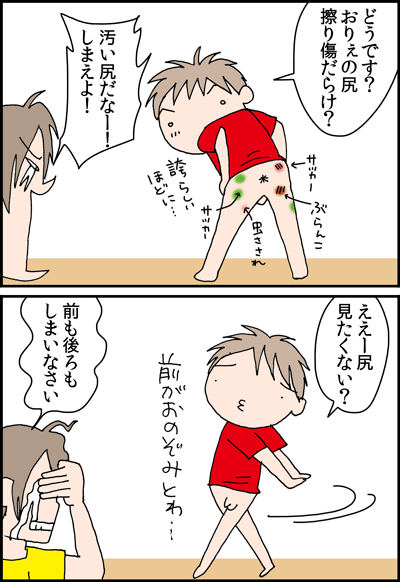 ちくわの穴から星☆を見た *4コマ-尻傷1