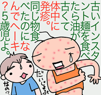 じんましん