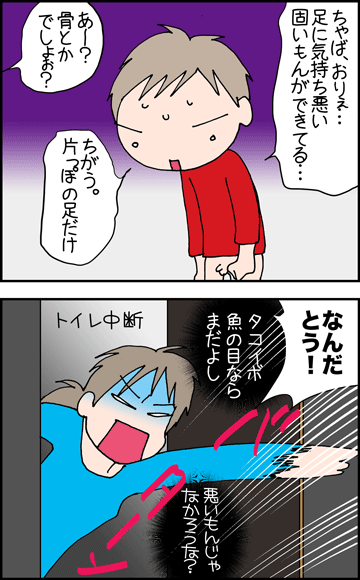 ちくわの穴から星☆を見た ＊4コマ-足１