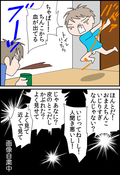 ちくわの穴から星☆を見た *4コマ-ちんこ1