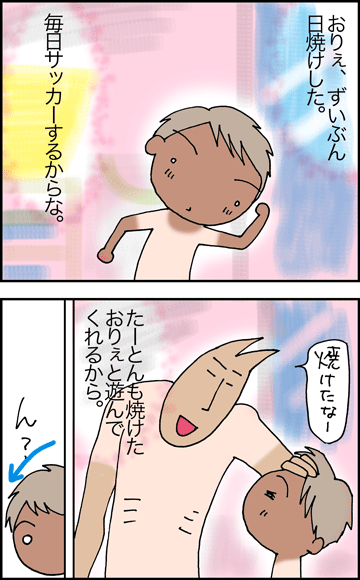 ちくわの穴から星☆を見た ＊4コマ-日焼け１