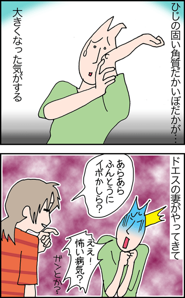ちくわの穴から星☆を見た ＊4コマ-おでき？１