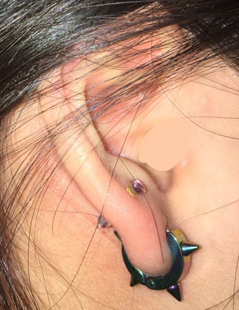 うp ピアス穴開けたんやが斜めすぎる気がする 開け直すべき 男子ファッション速報 うp ピアス穴開けたんやが斜めすぎる気がする 開け直すべき 男子ファッション速報