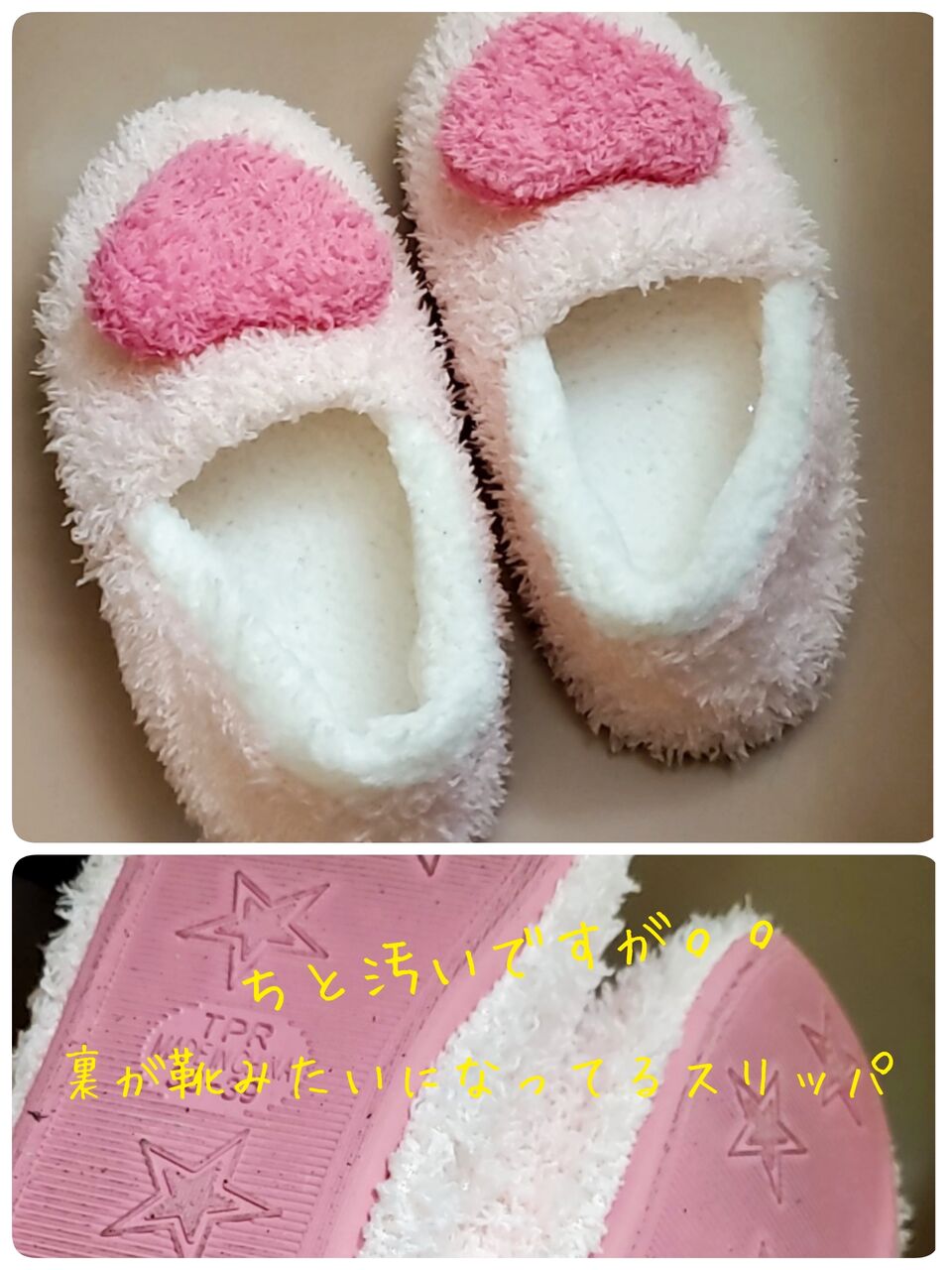 入院準備リスト紹介 シロッカー手術 不妊高齢出産 24週完全破水 26週出産 Nicu 超低体重児