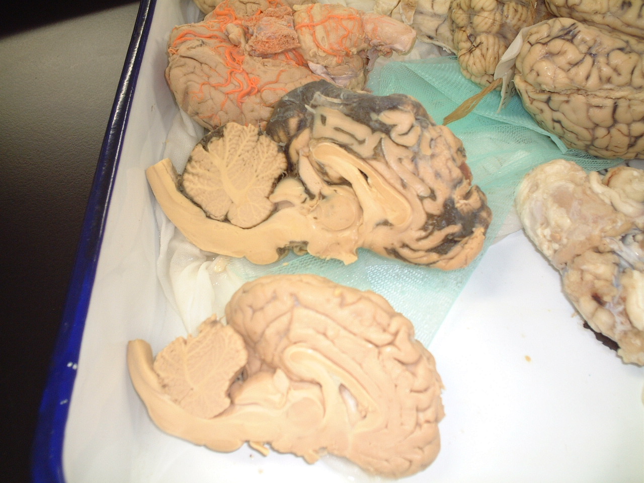 今日は内分泌系 : vetmaking