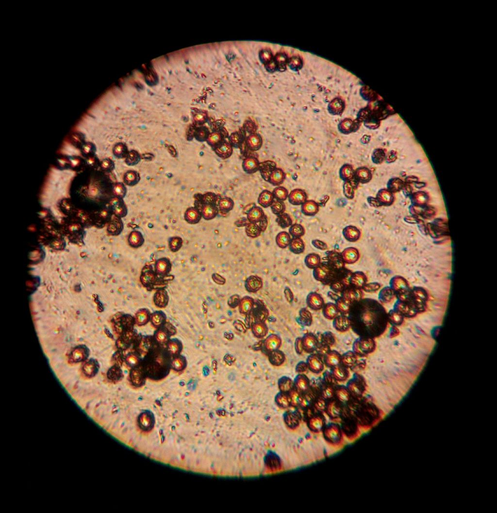 ヒイラギナンテンの花粉 顕微鏡 みどりの搭乗員