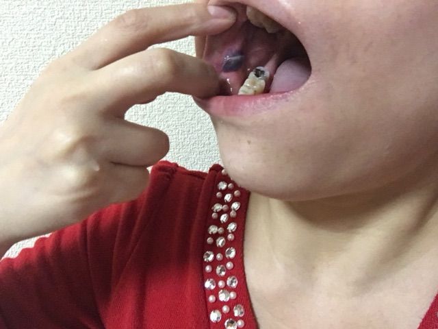 16年11月 疲れた女のブログ 16年11月 疲れた女のブログ