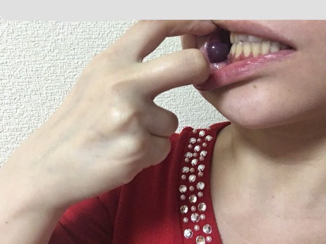 閲覧注意 口の中の血豆 疲れた女のブログ 閲覧注意 口の中の血豆 疲れた女のブログ
