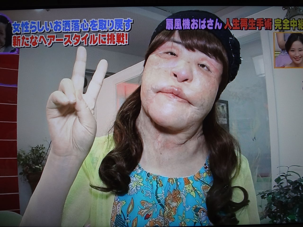 扇風機おばさんの人生再生手術が始まった ぱ す た い む 扇風機おばさんの人生再生手術が始まった ぱ す た い む