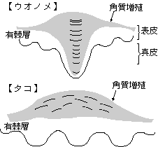 ウオノメとタコ皮膚科学会