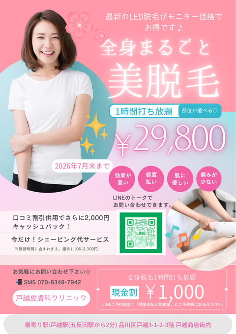 ピンク 水色 かわいい 美容脱毛 A4チラシ (1)