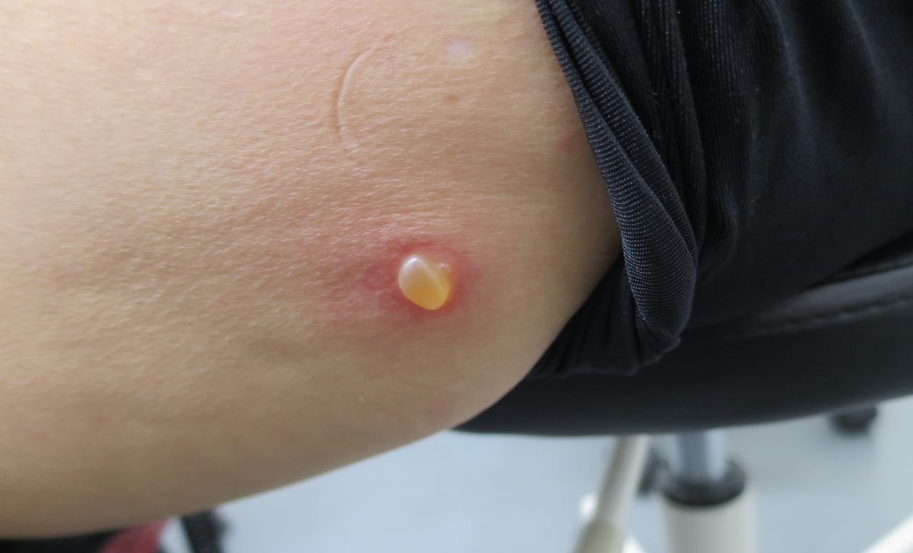 19年07月 戸越皮膚科クリニックのブログ