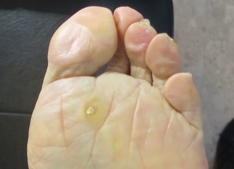 IMG_5582-t1000鶏目