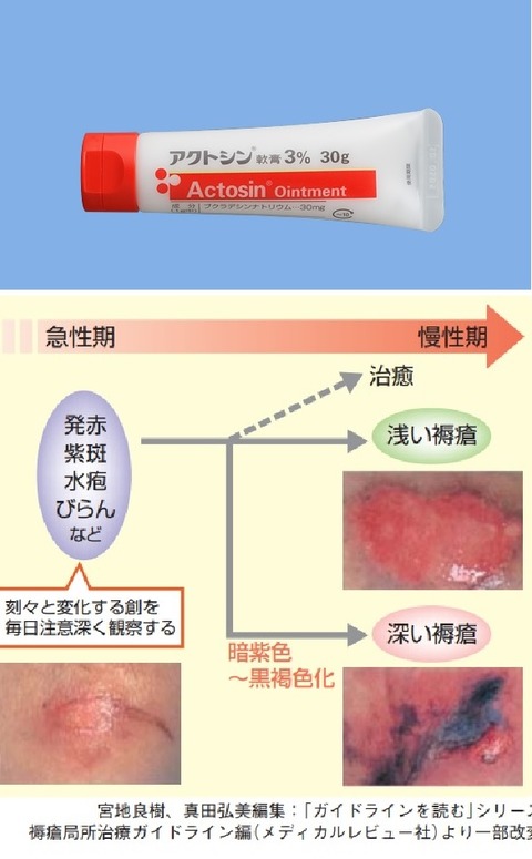 アクトシンと褥瘡