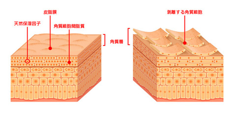 アトピーマルホ