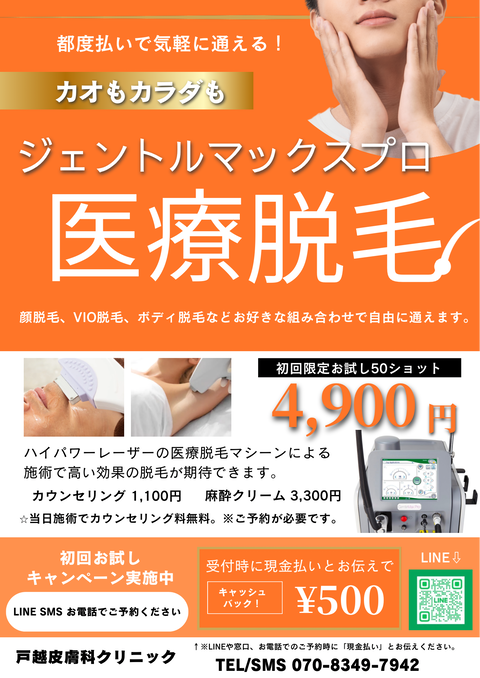 黒 金 かっこいい メンズ脱毛 A4チラシ (1)