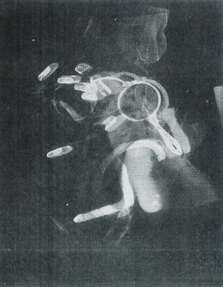 fig.6