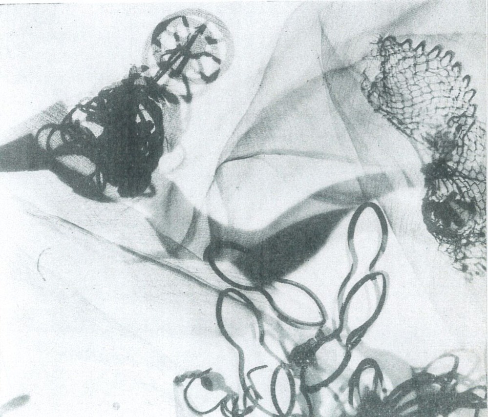 fig.4