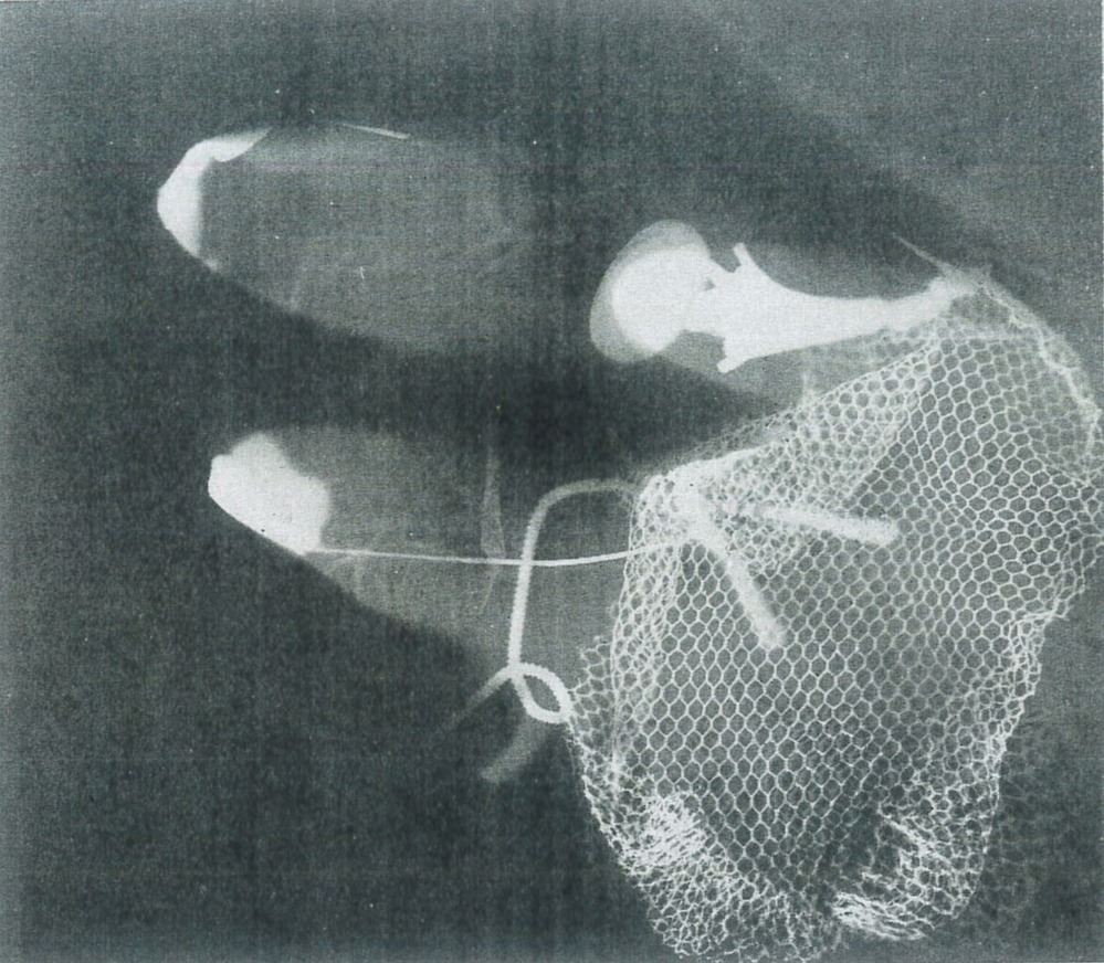 fig.3