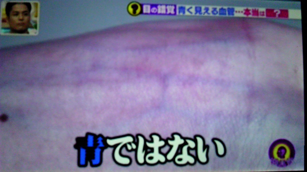 血管が青に見えるのは 目の錯覚 蜻蛉の一人言 血管が青に見えるのは 目の錯覚 蜻蛉の一人言