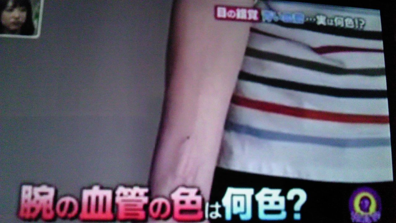 血管が青に見えるのは 目の錯覚 蜻蛉の一人言