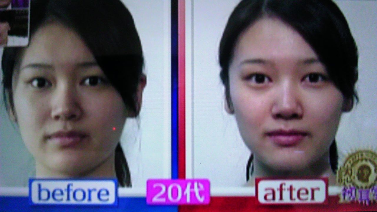 肩凝りを放っておくと 目が小さくなる 蜻蛉の一人言