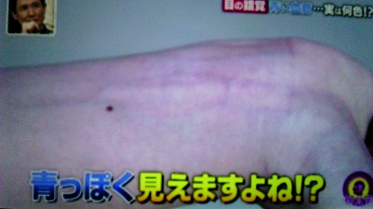 血管が青に見えるのは 目の錯覚 蜻蛉の一人言 血管が青に見えるのは 目の錯覚 蜻蛉の一人言