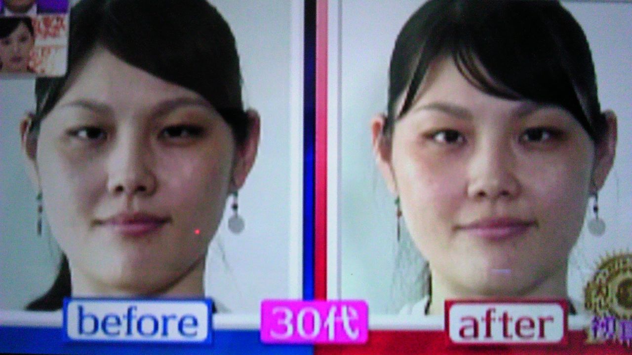 肩凝りを放っておくと 目が小さくなる 蜻蛉の一人言