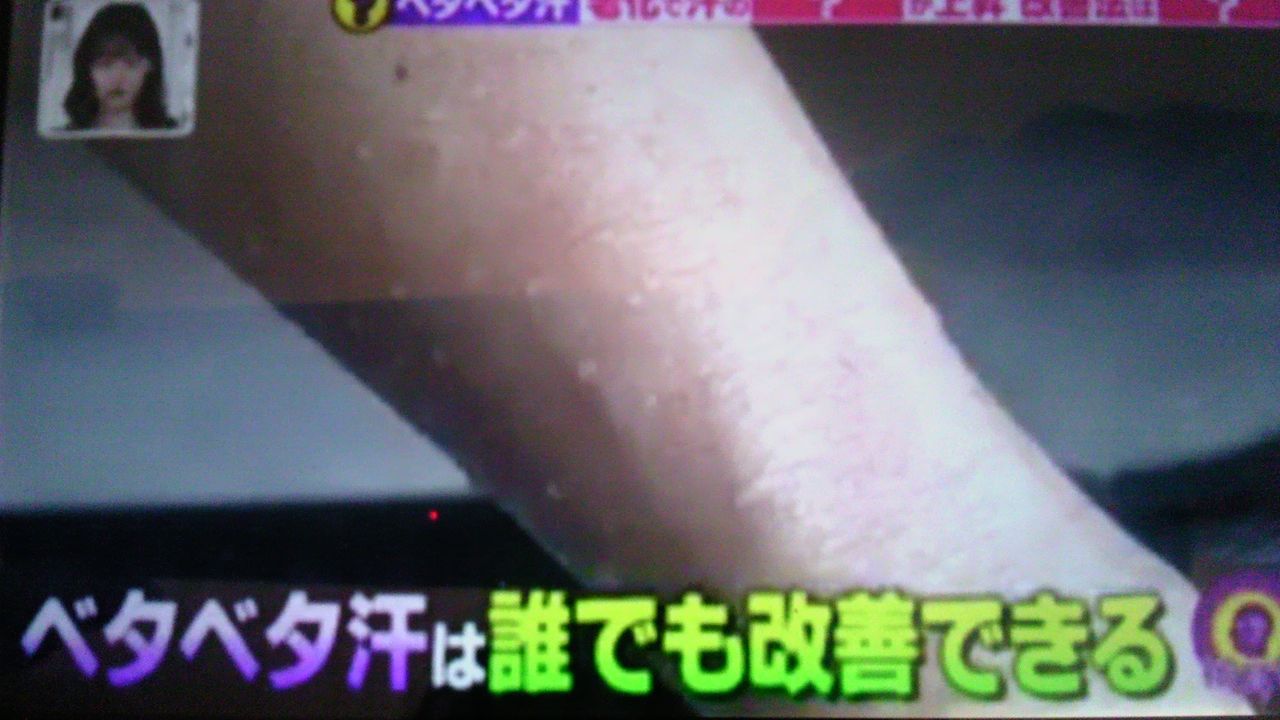 ベタベタ汗の原因は老化 蜻蛉の一人言