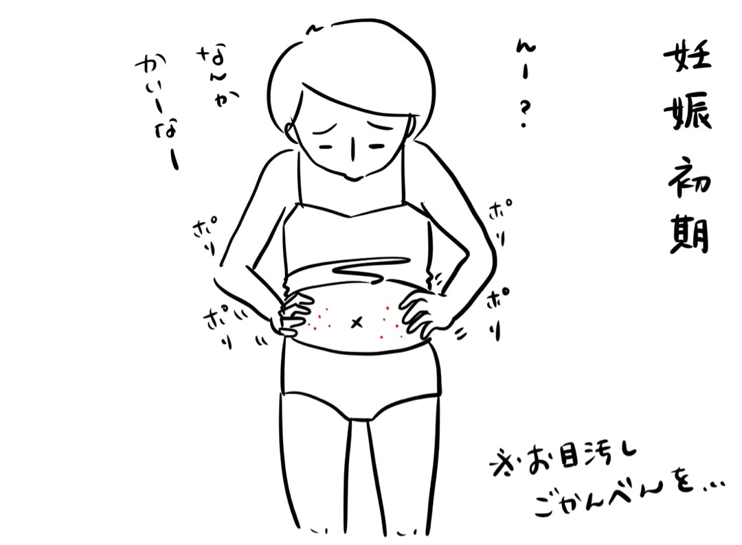 イボ 疣贅 ゆうぜい 新宿 高田馬場の皮膚科 美容皮膚科 山手皮フ科クリニック