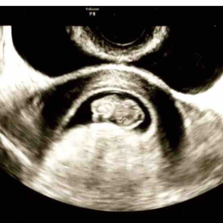 その他 とむ子絵日記