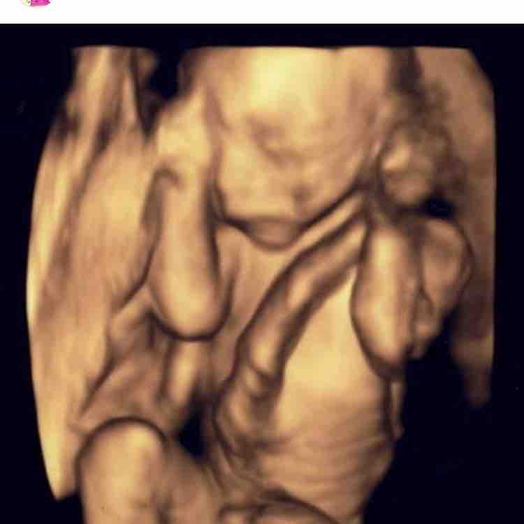 その他 とむ子絵日記