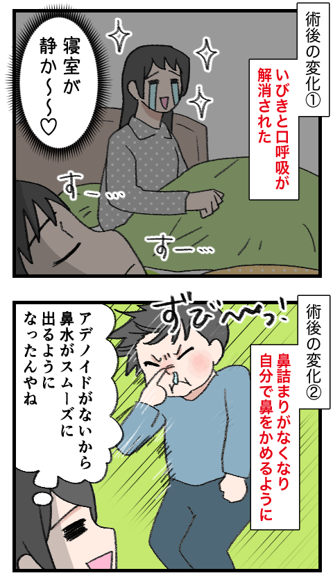アデノイド27