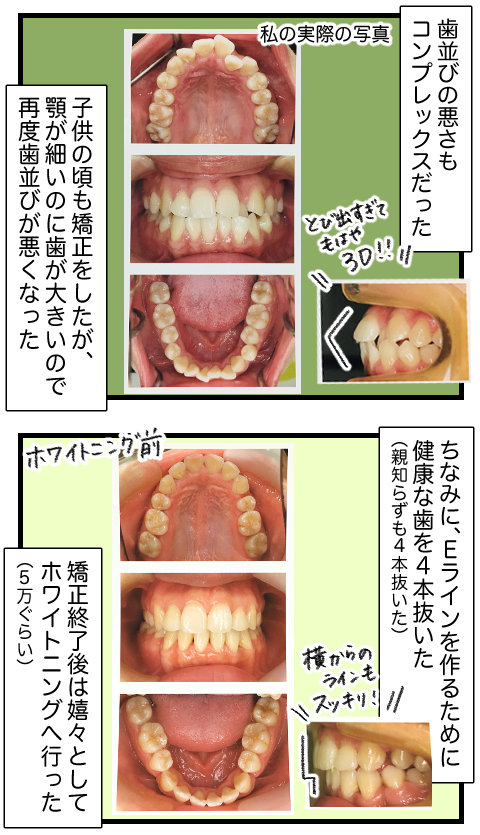 整形トータル2-2