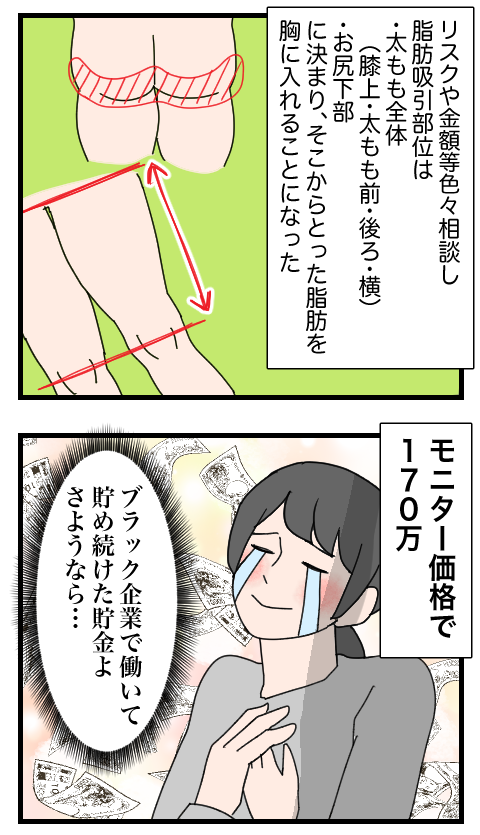 整形11