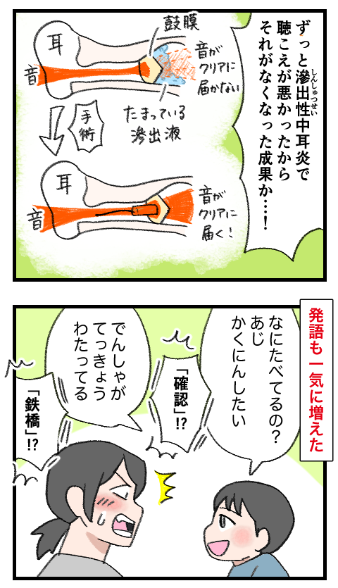 アデノイド27-3