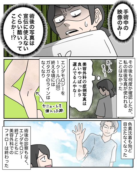 整形30-2