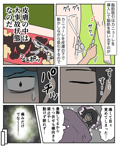 整形16-2