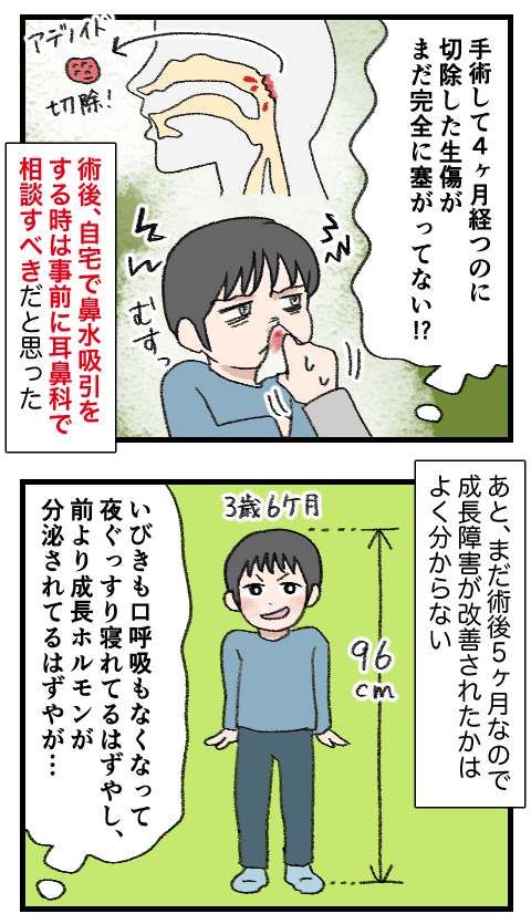 アデノイド28-3