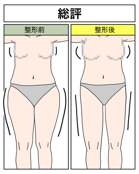 整形31