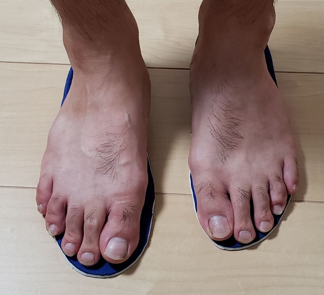 100均でも インソールのパワーテスト 耐えられます ペン粒が古武術卓球を独学してみたが 布袋卓球アカデミーに入会したので 独学じゃなくなった