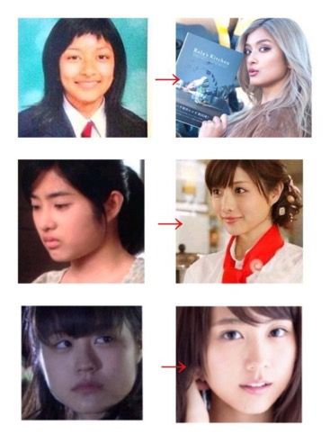 芸能人の顔の変化って 整形 成長 ツイッターまとめbox ツイbox 芸能人の顔の変化って 整形 成長 ツイッターまとめbox ツイbox