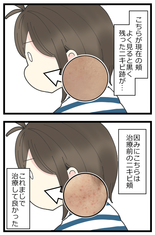 blog220704_3