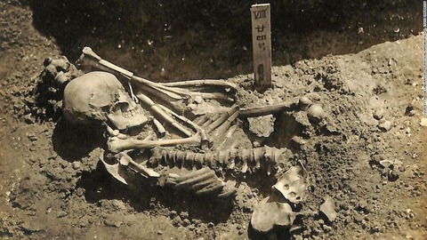 津雲貝塚から発掘された成人男性の遺骨